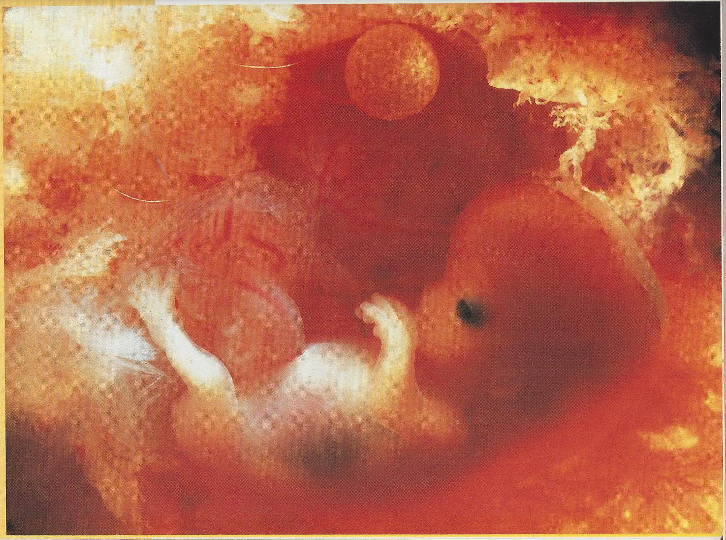 Десятка недели. 10 Недель беременности фото плода. Малыш в утробе матери.